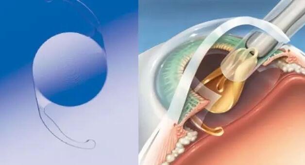 QQ截图20170313164843.jpg QQ截图20170313164843.jpg