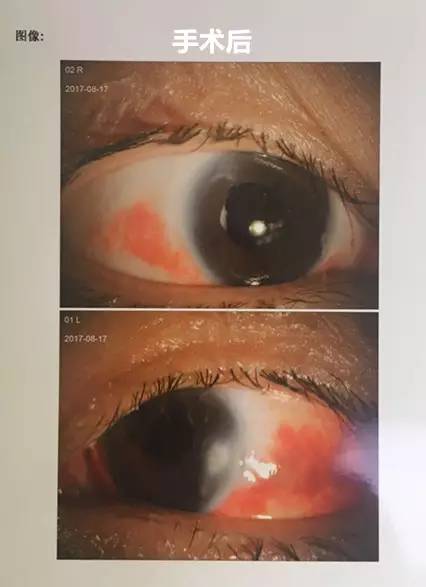 成都金沙9001以诚为本白内障.jpg