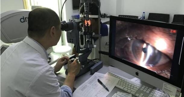 10月29日,一位职业性白内障男子,在厦门眼科中心手术后 复明。值得一提的,不少人对于其从事职业会导致的“职业性白内障”并不在意,但根据厦门眼科中心白内障专科陈伟主任介绍,在接诊中,职业性白内障并不少见,对于这些行业从业人员如何做好眼病防护,也进行了详细的介绍。.jpg 10月29日,一位职业性白内障男子,在厦门眼科中心手术后 复明。值得一提的,不少人对于其从事职业会导致的“职业性白内障”并不在意,但根据厦门眼科中心白内障专科陈伟主任介绍,在接诊中,职业性白内障并不少见,对于这些行业从业人员如何做好眼病防护,也进行了详细的介绍。.jpg