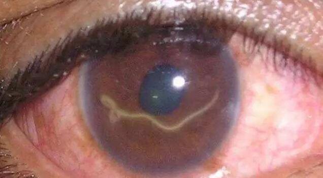 如果进去的异物真的是很小的话,就是一个小飞虫或者是一个小颗粒这个时候家长可以让孩子闭上眼睛,因为眼睛自身有保护自己的机制,所以这样的小东西有时候眼睛是可以自己解决的,不用家长担心.jpg 如果进去的异物真的是很小的话,就是一个小飞虫或者是一个小颗粒这个时候家长可以让孩子闭上眼睛,因为眼睛自身有保护自己的机制,所以这样的小东西有时候眼睛是可以自己解决的,不用家长担心.jpg