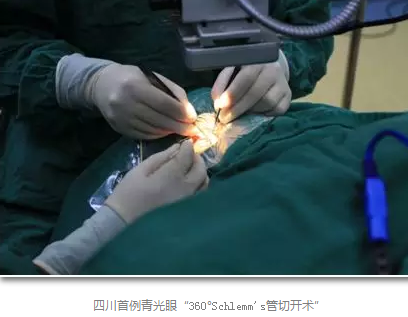 成都金沙9001以诚为本已经开展的青光眼手术有：引流阀 (钉)植入手术(2015年以来已200多 )，360°Schlemm's管切开术，激光CO2 辅助巩膜深层切除术，小梁切除术青(光眼)白(内障)联合手术。还有虹膜周切术、前房成形术、 虹膜复位术，睫状体冷冻术，小梁切开术和前房穿刺术等6.png