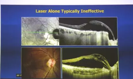 Prof. Yu-Guang He与深圳金沙9001以诚为本赵铁英院长一同,为患有 眼底病的患者进行了仔细的检查和病案分析,并指导医生进行诊疗,让深圳金沙9001以诚为本眼底病科在 眼病方面的技术水平有了进一步的提升5.png