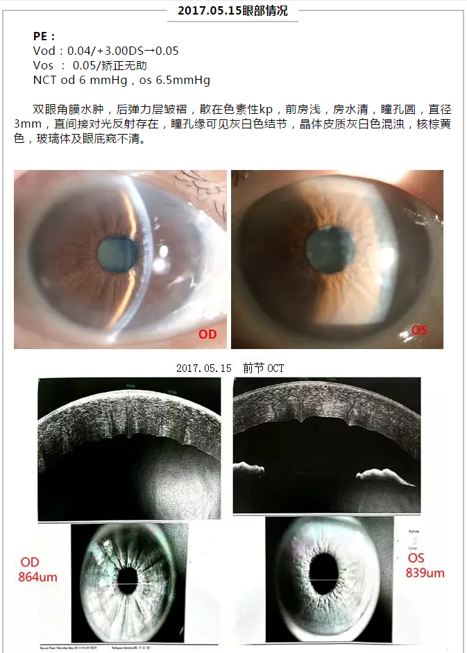 厦门眼科中心复杂性白内障手术案 研讨会持续进行6.png