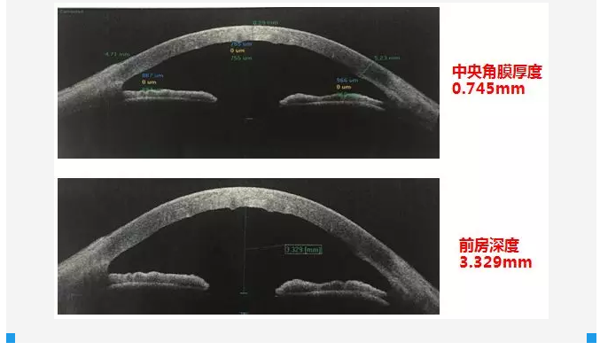 厦门眼科中心复杂性白内障手术案 研讨会持续进行14.png