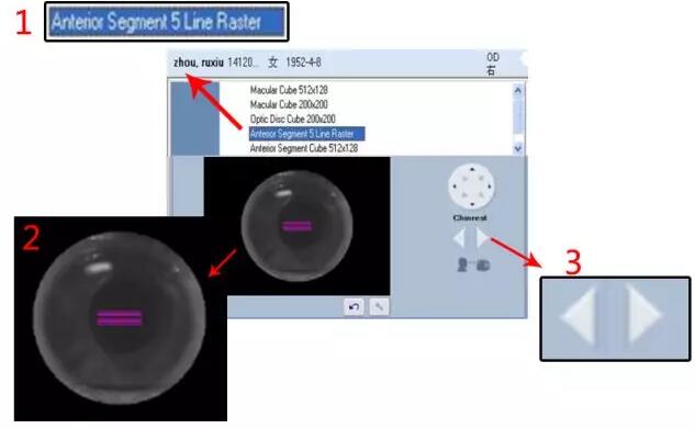 金沙9001以诚为本课堂:后节频域OCT前节模块的运用1.jpg 金沙9001以诚为本课堂:后节频域OCT前节模块的运用1.jpg