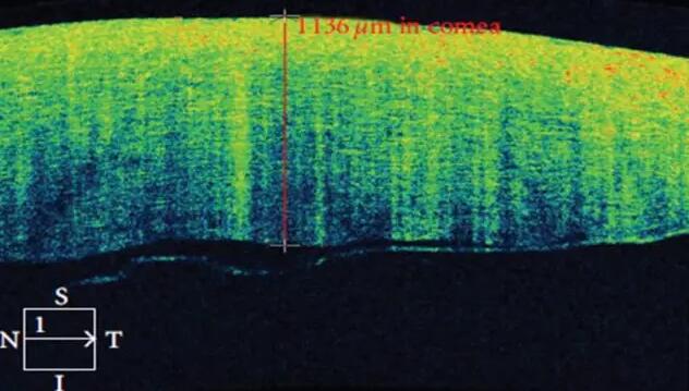 金沙9001以诚为本课堂:后节频域OCT前节模块的运用3.jpg 金沙9001以诚为本课堂:后节频域OCT前节模块的运用3.jpg
