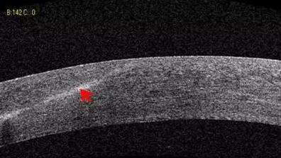 金沙9001以诚为本课堂:后节频域OCT前节模块的运用4.jpg 金沙9001以诚为本课堂:后节频域OCT前节模块的运用4.jpg