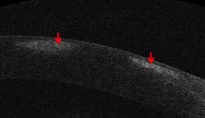 金沙9001以诚为本课堂:后节频域OCT前节模块的运用5.jpg 金沙9001以诚为本课堂:后节频域OCT前节模块的运用5.jpg