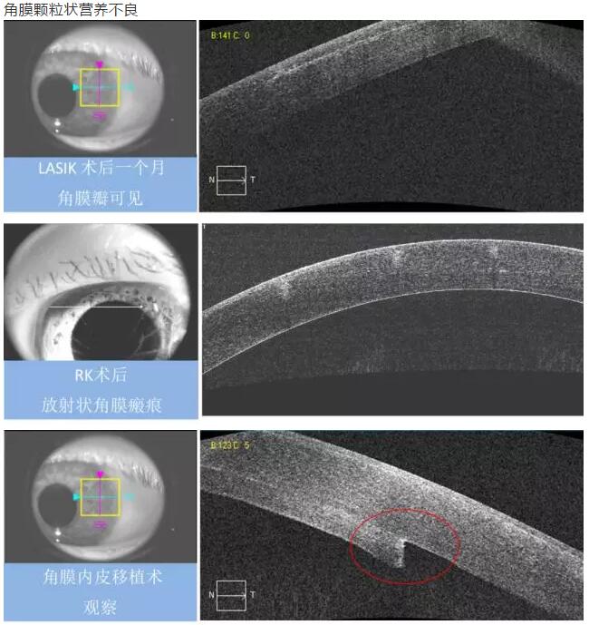 金沙9001以诚为本课堂:后节频域OCT前节模块的运用11.jpg 金沙9001以诚为本课堂:后节频域OCT前节模块的运用11.jpg