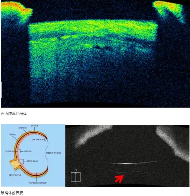 金沙9001以诚为本课堂:后节频域OCT前节模块的运用14.jpg 金沙9001以诚为本课堂:后节频域OCT前节模块的运用14.jpg