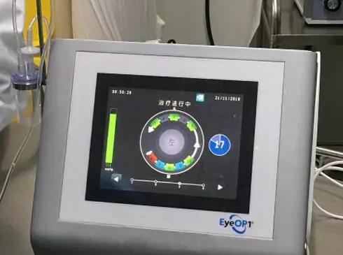 成都金沙9001以诚为本医院院长陈晓明教授为资阳市安岳县青光眼患者进行青光眼超声睫状体成形术3.jpg 成都金沙9001以诚为本医院院长陈晓明教授为资阳市安岳县青光眼患者进行青光眼超声睫状体成形术3.jpg