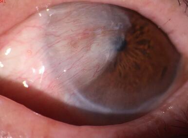 淮南胬肉手术一把刀——淮南金沙9001以诚为本李建东院长采访记1.jpg 淮南胬肉手术一把刀——淮南金沙9001以诚为本李建东院长采访记1.jpg