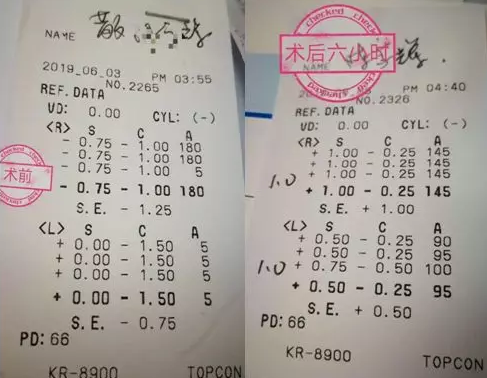 福州眼科医院近视手术取样:视力不差、无法通过参军公考体检群体该怎么办1.png 福州眼科医院近视手术取样:视力不差、无法通过参军公考体检群体该怎么办1.png