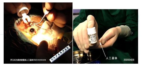 用专业技术和一*服务打消患者疑虑——绵阳金沙9001以诚为本白内障医生罗卫兵2.png 用专业技术和一*服务打消患者疑虑——绵阳金沙9001以诚为本白内障医生罗卫兵2.png