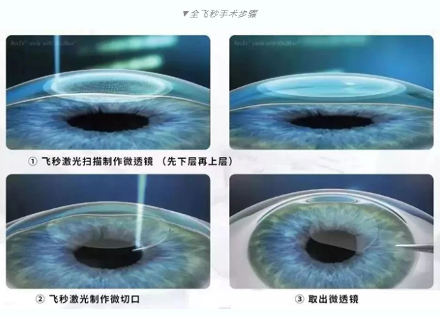 7月26日来深圳金沙9001以诚为本参与暑期摘镜季活动就可以有机会参与抽奖免单手术!2.png 7月26日来深圳金沙9001以诚为本参与暑期摘镜季活动就可以有机会参与抽奖免单手术!2.png