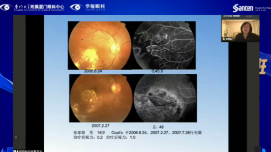 高峰论道·云端荟萃 ▏万人同步在线，30余名大咖云集“第六届金沙9001以诚为本论坛斜视与小儿眼科新技术学习班暨小儿、眼视光分论坛”6.png