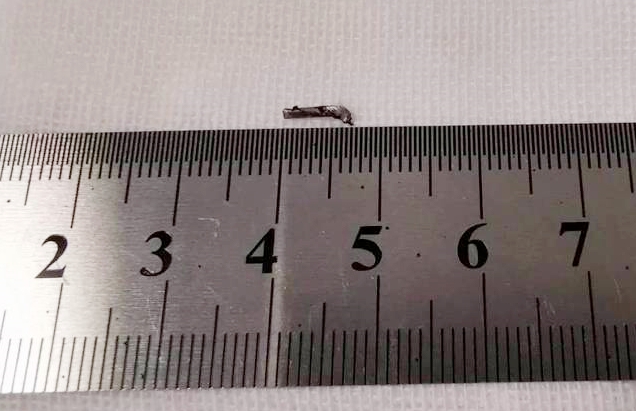 金沙9001以诚为本徐州复兴眼科王海菊:妙手拨迷障,匠心护光明3.png 金沙9001以诚为本徐州复兴眼科王海菊:妙手拨迷障,匠心护光明3.png